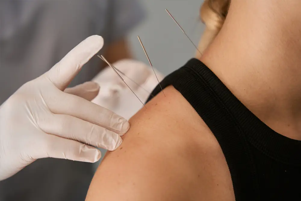 acupuncture on neck