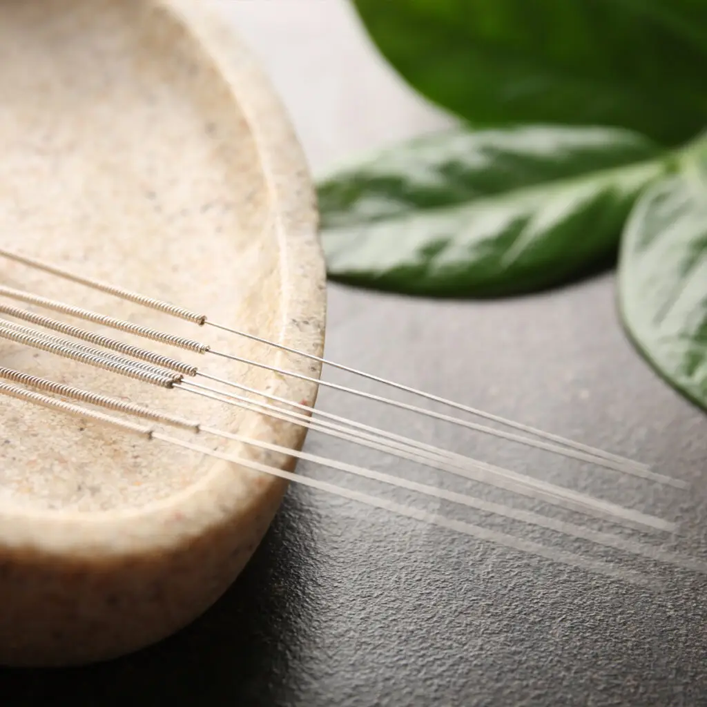 holistic acupuncture needles