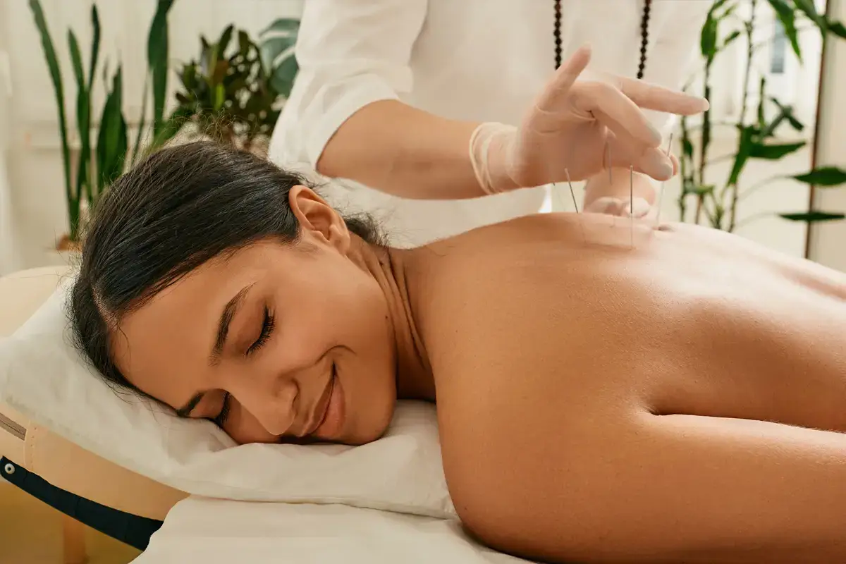 acupuncture