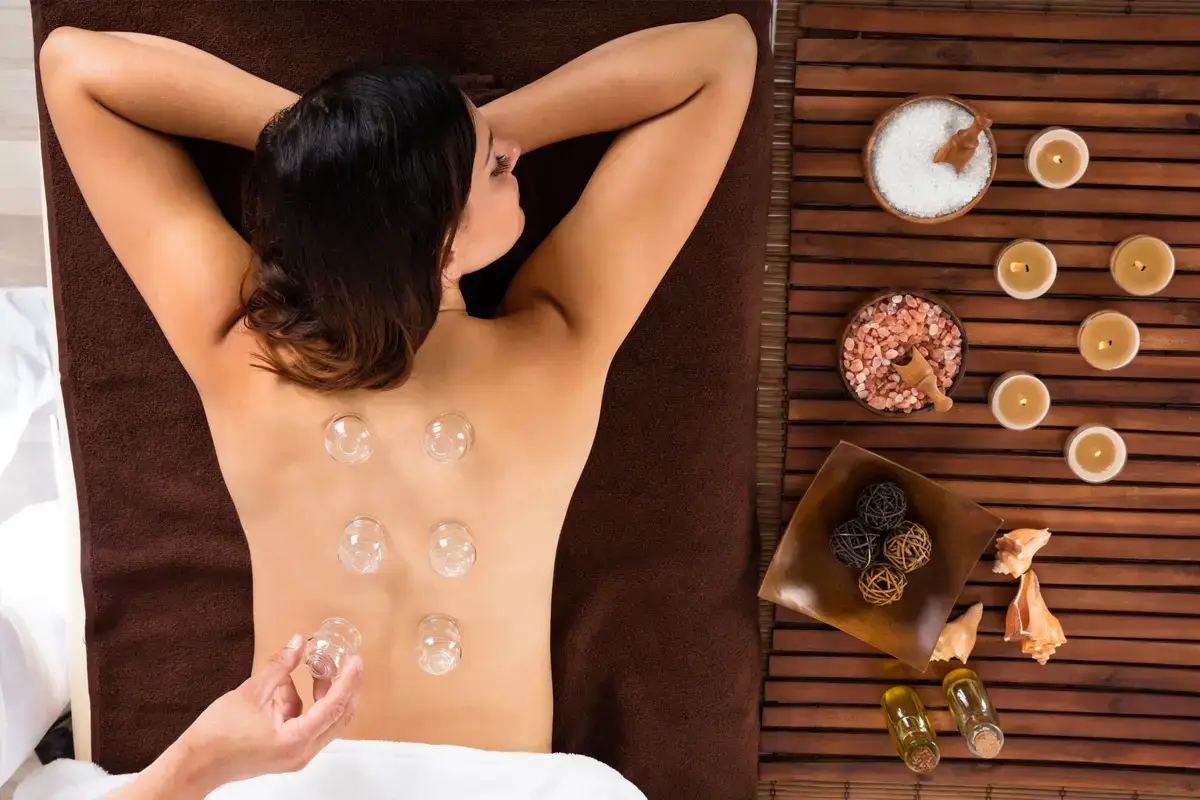 cupping therapy
